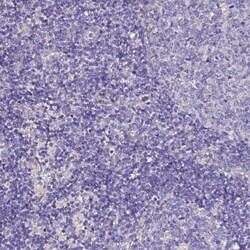 SLC44A3 Antibody, Novus Biologicals 0.1mL; Unlabeled:Antibodies, Polyclonal