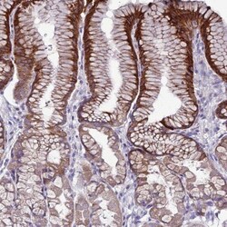 SLC44A3 Antibody, Novus Biologicals 0.1mL; Unlabeled:Antibodies, Polyclonal