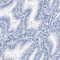 SLC45A3/Prostein Antibody, Novus Biologicals:Antibodies:Primary Antibodies