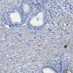 SLC45A3/Prostein Antibody, Novus Biologicals:Antibodies:Primary Antibodies