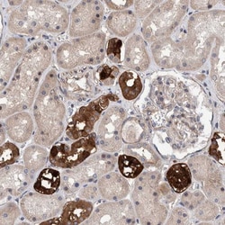 SLC45A4 Antibody, Novus Biologicals 0.1mL; Unlabeled:Antibodies, Polyclonal