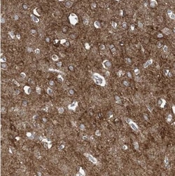 SLC4A10 Antibody, Novus Biologicals 0.1mL; Unlabeled:Antibodies, Polyclonal