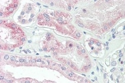 SLC4A11 Antibody, Novus Biologicals 0.1mg; Unlabeled:Antibodies, Polyclonal