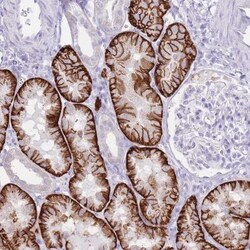 SLC4A4 Antibody, Novus Biologicals 0.1 mL | Buy Online | Novus Biologicals | Fisher Scientific