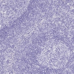 SLC4A4 Antibody, Novus Biologicals 0.1 mL | Buy Online | Novus Biologicals | Fisher Scientific