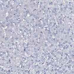 SLC4A7/Sodium bicarbonate cotransporter 3 Antibody, Novus Biologicals:Antibodies:Primary