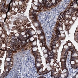 SLC4A7/Sodium bicarbonate cotransporter 3 Antibody, Novus Biologicals:Antibodies:Primary