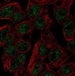SLC5A11 Antibody, Novus Biologicals 25 &mu;L; Unlabeled:Antibodies, Polyclonal
