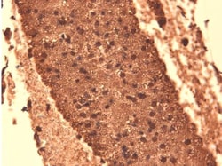 SLC5A5/Sodium Iodide Symporter Antibody (14F), Novus Biologicals:Antibodies:Primary