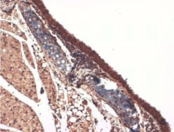 SLC5A5/Sodium Iodide Symporter Antibody (14F), Novus Biologicals:Antibodies:Primary