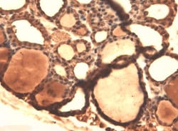 SLC5A5/Sodium Iodide Symporter Antibody (14F), Novus Biologicals:Antibodies:Primary