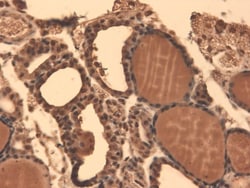 SLC5A5/Sodium Iodide Symporter Antibody (FP5), Novus Biologicals 0.1mg;