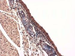 SLC5A5/Sodium Iodide Symporter Antibody (FP5), Novus Biologicals 0.1mg;