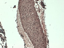 SLC5A5/Sodium Iodide Symporter Antibody (FP5), Novus Biologicals 0.1mg;