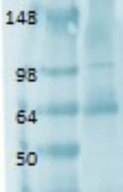 SLC5A5/Sodium Iodide Symporter Antibody (FP5), Novus Biologicals 0.1mg;