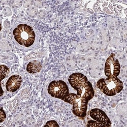 SLC5A5/Sodium Iodide Symporter Antibody, Novus Biologicals 0.1mL; Unlabeled:Antibodies,