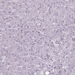 SLC5A5/Sodium Iodide Symporter Antibody, Novus Biologicals 0.1mL; Unlabeled:Antibodies,