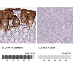 SLC5A5/Sodium Iodide Symporter Antibody, Novus Biologicals 0.1mL; Unlabeled:Antibodies,