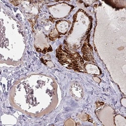 SLC5A5/Sodium Iodide Symporter Antibody, Novus Biologicals 0.1mL; Unlabeled:Antibodies,