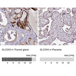 SLC5A5/Sodium Iodide Symporter Antibody, Novus Biologicals 0.1mL; Unlabeled:Antibodies,
