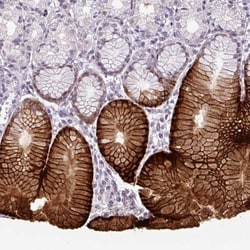SLC5A5/Sodium Iodide Symporter Antibody, Novus Biologicals 0.1mL; Unlabeled:Antibodies,