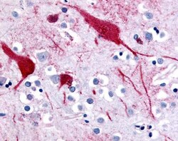 SLC5A9 Antibody - BSA Free, Novus Biologicals 0.05mg; Unlabeled:Antibodies,