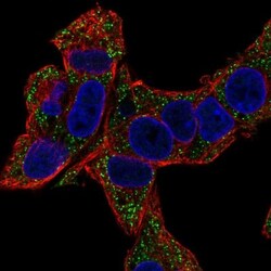 SLC6A14 Antibody, Novus Biologicals 0.1mL; Unlabeled:Antibodies