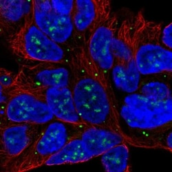 SLC6A15 Antibody, Novus Biologicals 0.1mL; Unlabeled:Antibodies, Polyclonal