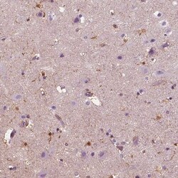 SLC6A17 Antibody, Novus Biologicals 0.1mL; Unlabeled:Antibodies, Polyclonal