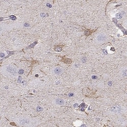 SLC6A17 Antibody, Novus Biologicals:Antibodies:Primary Antibodies