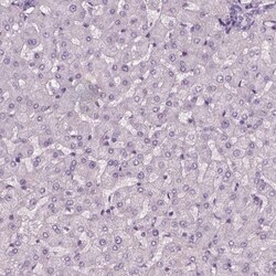 SLC6A17 Antibody, Novus Biologicals 0.1mL; Unlabeled:Antibodies, Polyclonal
