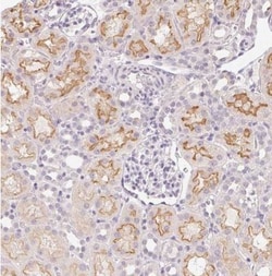 SLC6A18 Antibody, Novus Biologicals 0.1 mL | Buy Online | Novus Biologicals | Fisher Scientific