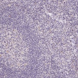 SLC6A18 Antibody, Novus Biologicals 0.1 mL | Buy Online | Novus Biologicals | Fisher Scientific