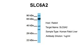 SLC6A2/NET/Noradrenaline transporter Antibody, Novus Biologicals 0.05mg;