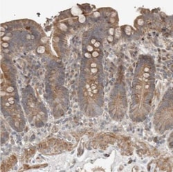 SLC6A7 Antibody, Novus Biologicals:Antibodies:Primary Antibodies