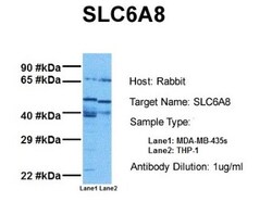 SLC6A8 Antibody, Novus Biologicals 0.1mg; Unlabeled:Antibodies, Polyclonal