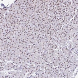SLC7A10 Antibody, Novus Biologicals 25 &mu;L, Unlabeled:Antibodies, Polyclonal