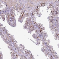 SLC7A14 Antibody, Novus Biologicals 25 &mu;L, Unlabeled:Antibodies, Polyclonal