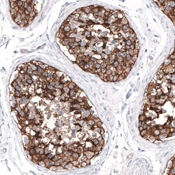 SLC7A5/LAT1 Antibody, Novus Biologicals:Antibodies:Primary Antibodies