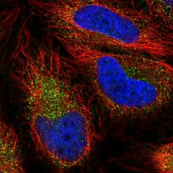 SLC7A6 Antibody, Novus Biologicals 0.1mL; Unlabeled:Antibodies, Polyclonal