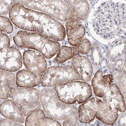 SLC7A7 Antibody, Novus Biologicals 25 &mu;L; Unlabeled:Antibodies, Polyclonal