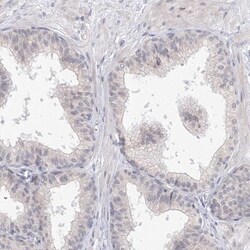 SLC7A7 Antibody, Novus Biologicals 25 &mu;L; Unlabeled:Antibodies, Polyclonal