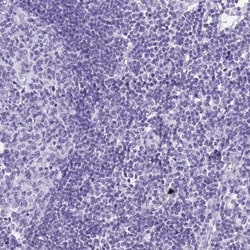 SLC7A9 Antibody, Novus Biologicals 25 &mu;L, Unlabeled:Antibodies, Polyclonal