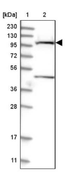 SLC9A2 Antibody, Novus Biologicals 0.1mL; Unlabeled:Antibodies, Polyclonal