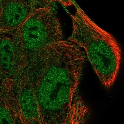 SLC9A4 Antibody, Novus Biologicals 25 &mu;L, Unlabeled:Antibodies, Polyclonal