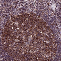 SLC9A5 Antibody, Novus Biologicals:Antibodies:Primary Antibodies