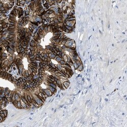 SLCO2A1 Antibody, Novus Biologicals 0.1mL; Unlabeled:Antibodies, Polyclonal