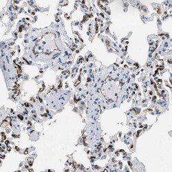 SLCO2A1 Antibody, Novus Biologicals 0.1mL; Unlabeled:Antibodies, Polyclonal