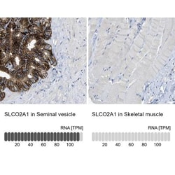 SLCO2A1 Antibody, Novus Biologicals 0.1mL; Unlabeled:Antibodies, Polyclonal