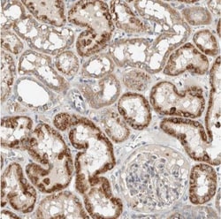 SLFN12L Antibody, Novus Biologicals:Antibodies:Primary Antibodies